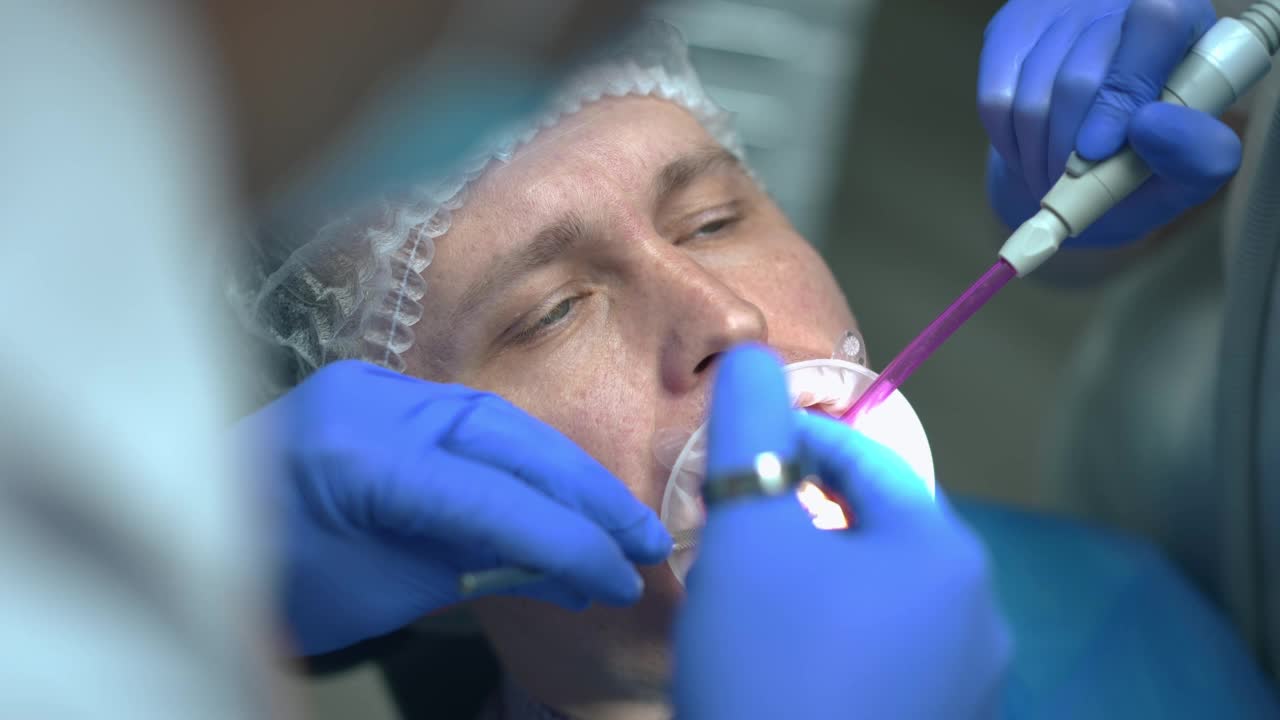 一名男子接受牙科检查的头部照片，不明身份的医生正在检查牙齿，作为助手用吸吮管清除唾液。坐在牙科椅上的白人病人的特写肖像。视频素材