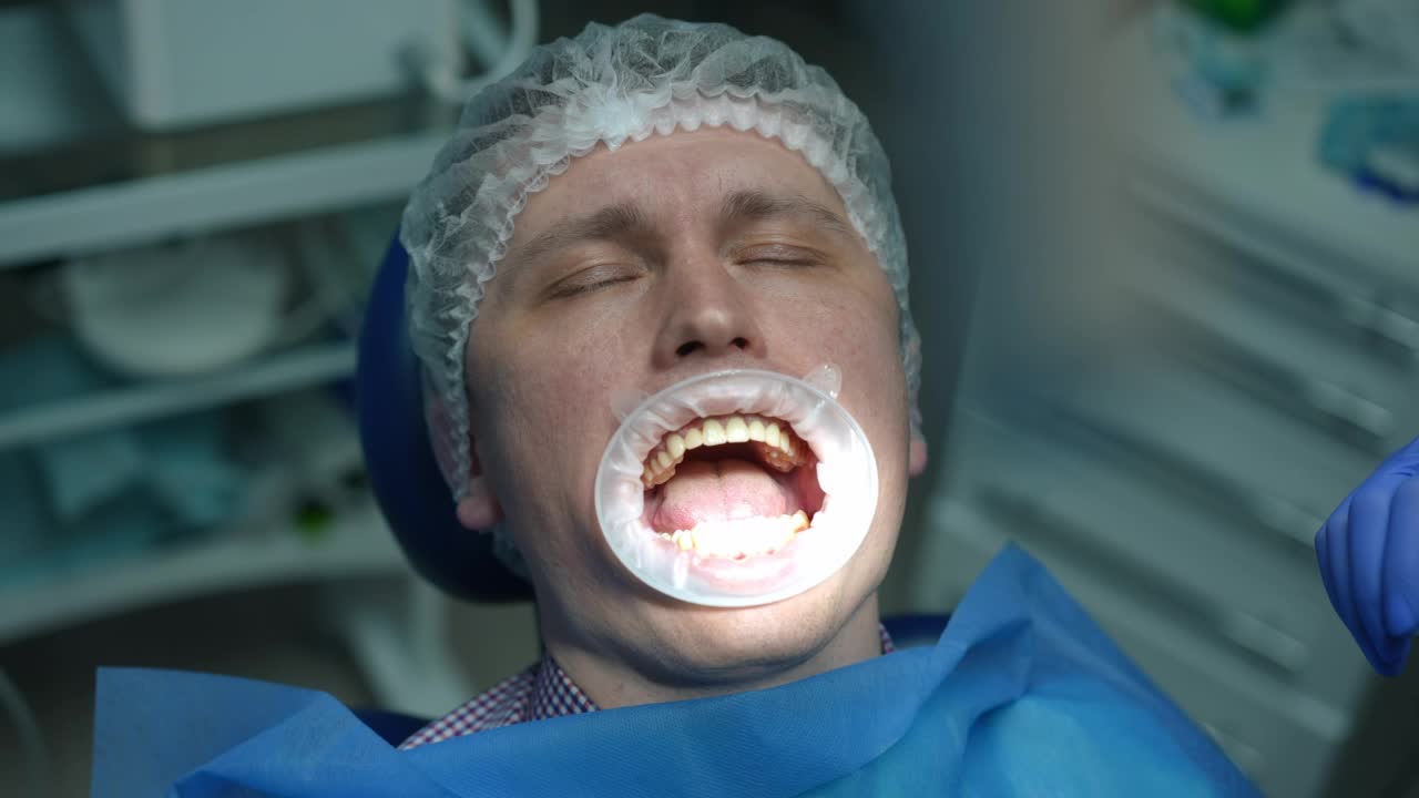 特写男子在牙科椅子与医生和护士使用钻和吮吸管在慢动作。白种人牙痛病人在医院与牙医和助手的高角度视角画像。视频素材