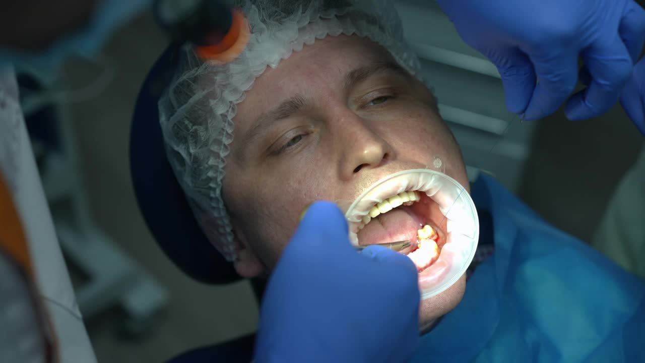 特写病人与口腔牵开器在牙科椅和外科医生缝合口腔牙龈在慢动作。专业牙科医生为住院病人缝合伤口。视频素材