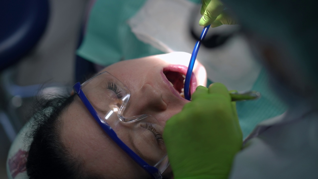 医生用吸吮管和镜子在牙科椅上用慢镜头观察病人的高角度面部。身份不明的专业牙医在医院检查白人妇女的牙齿。视频素材