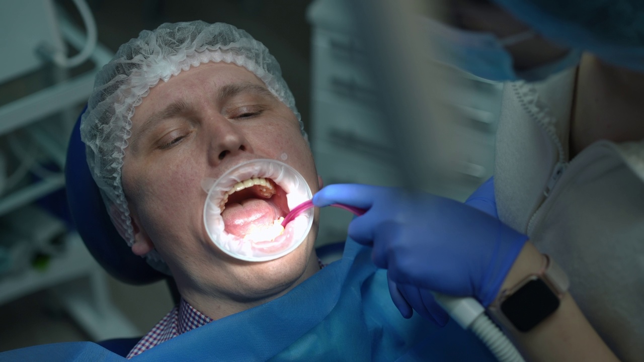 一名白人男子的头部特写，口腔牵开器张开眼睛，牙医带着钻头离开，助手用吸吮管清除唾液。病人在医院接受治疗的特写照片。视频素材