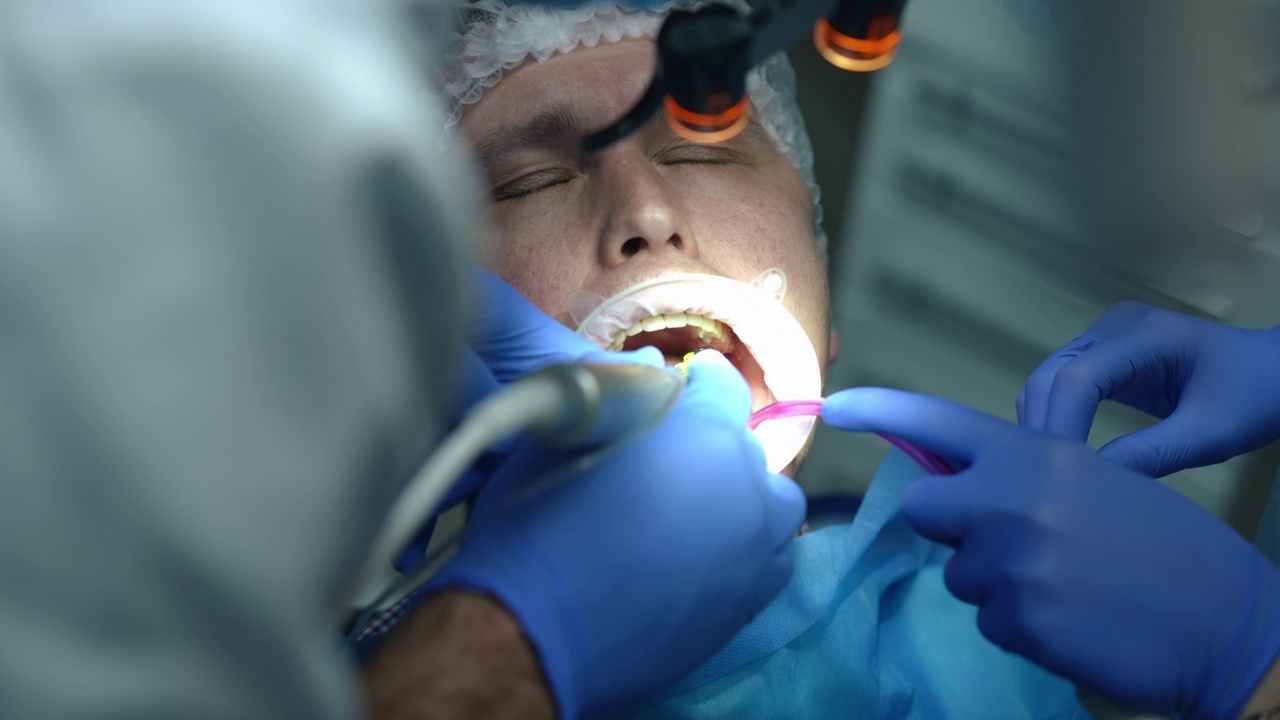 特写钻病牙在牙科诊所的慢动作。白人男子闭着眼睛坐在牙科椅上，与牙医和助手一起治疗病人。口腔正畸学的概念。视频素材