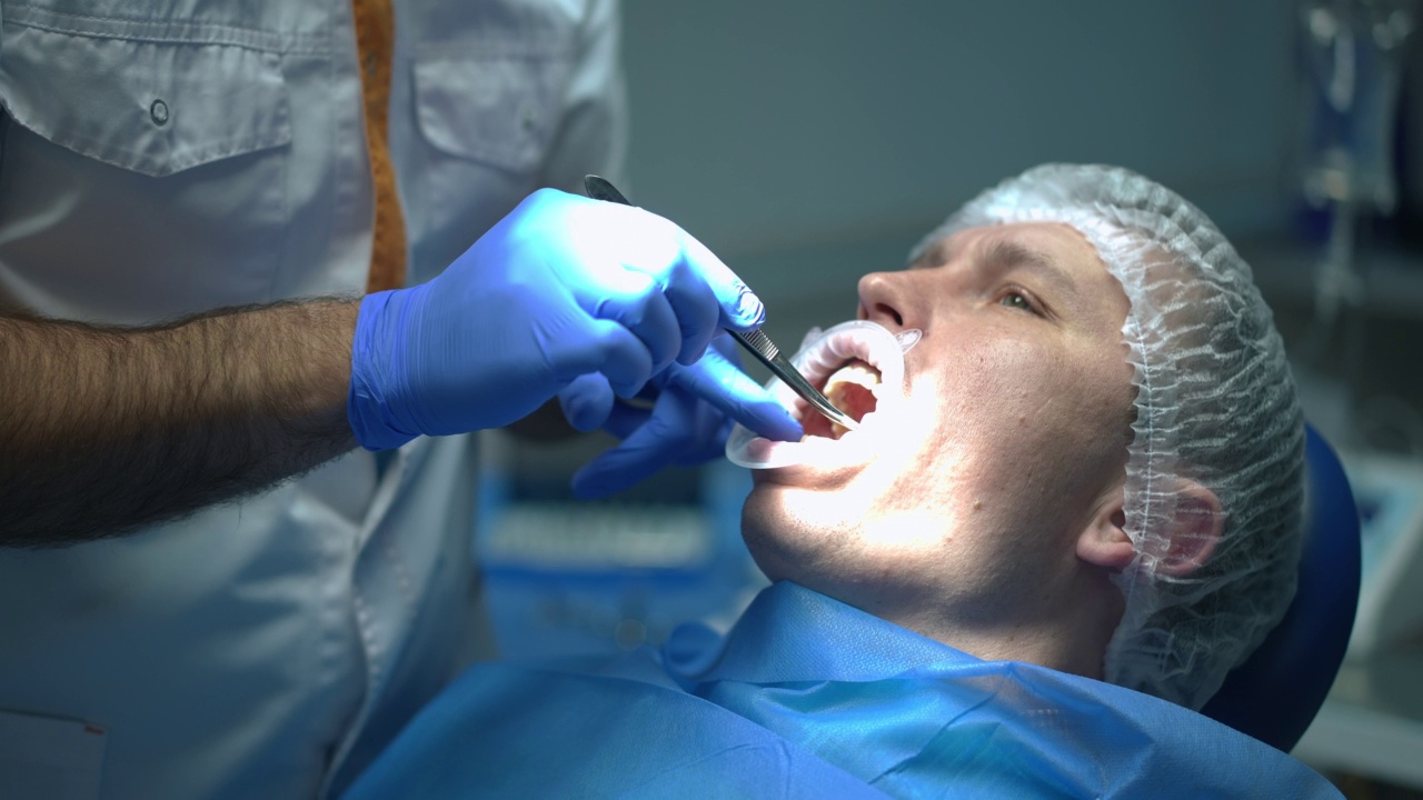 不明身份的牙医在牙科椅上检查病人口腔的慢镜头。中东医生治疗白人牙痛。口腔和牙科的概念。视频素材