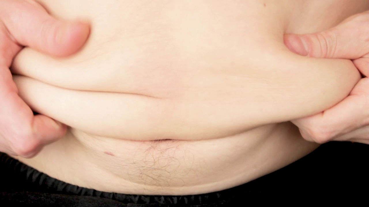 男人腹部脂肪。脂肪的褶皱，皮下脂肪组织。腰围,体重超标。视频素材