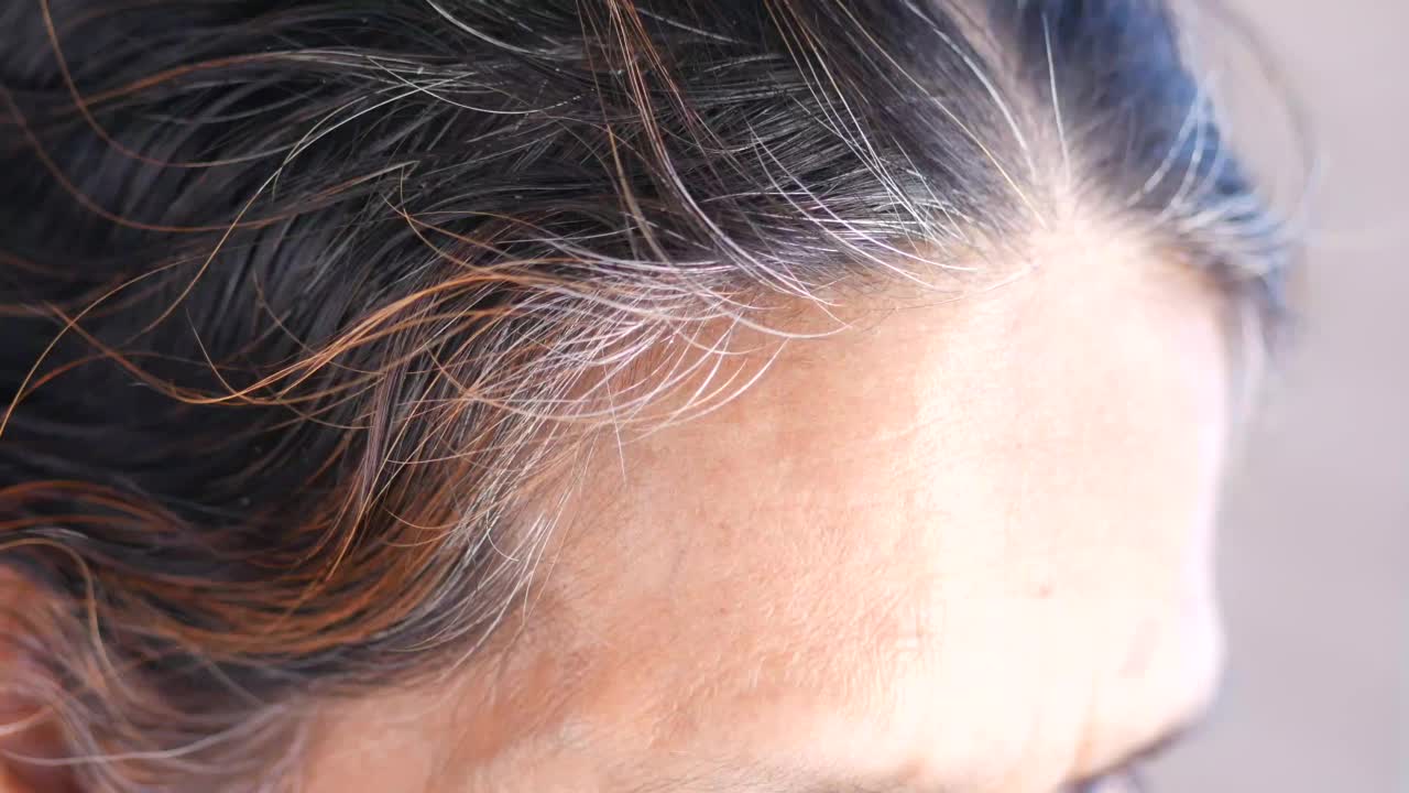 黑白混合的头发，视频下载