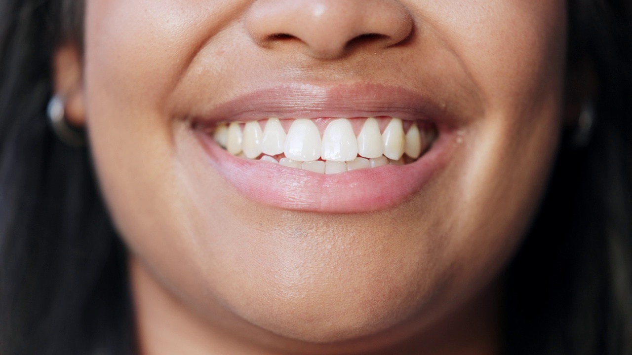 接受牙齿矫正、牙齿美白治疗或程序的病人，微笑着露出洁白牙齿的特写。快乐女人的头像宣传健康的口腔和牙齿护理常规视频素材