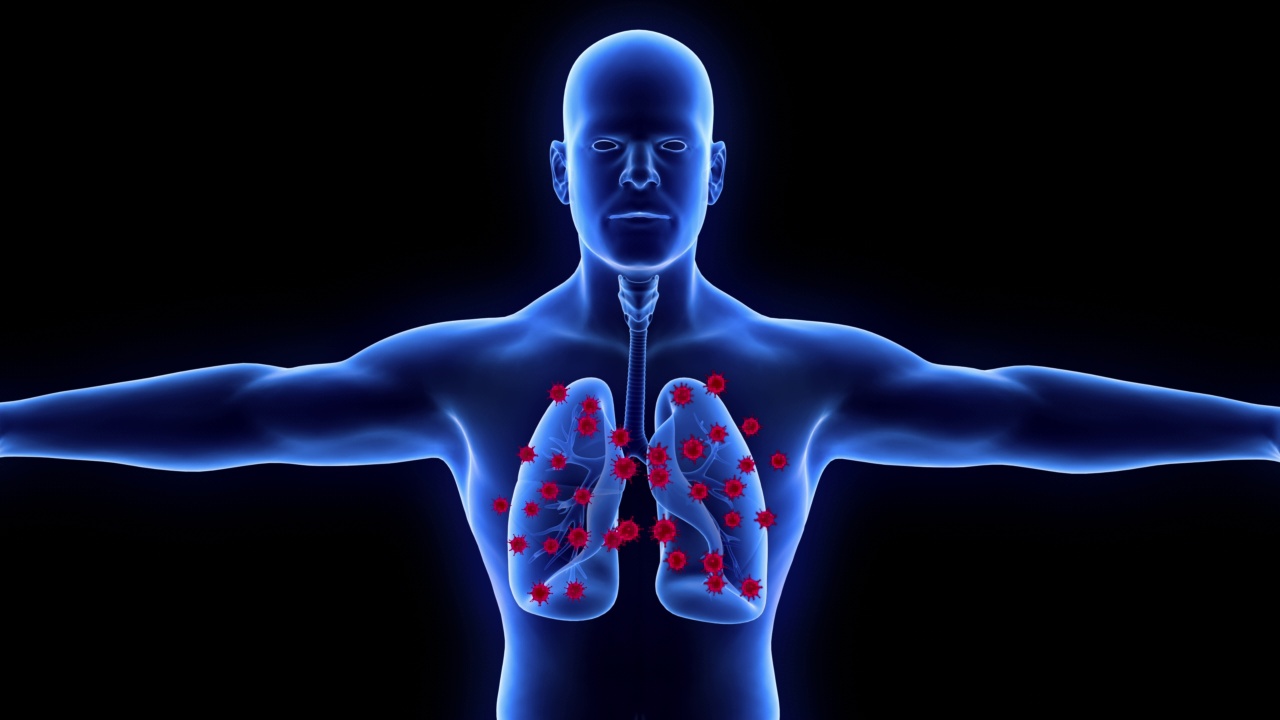人类肺部感染冠状病毒或病毒，由病毒引起的呼吸道感染，Ncov, Covid 19, Ncov 2019视频下载