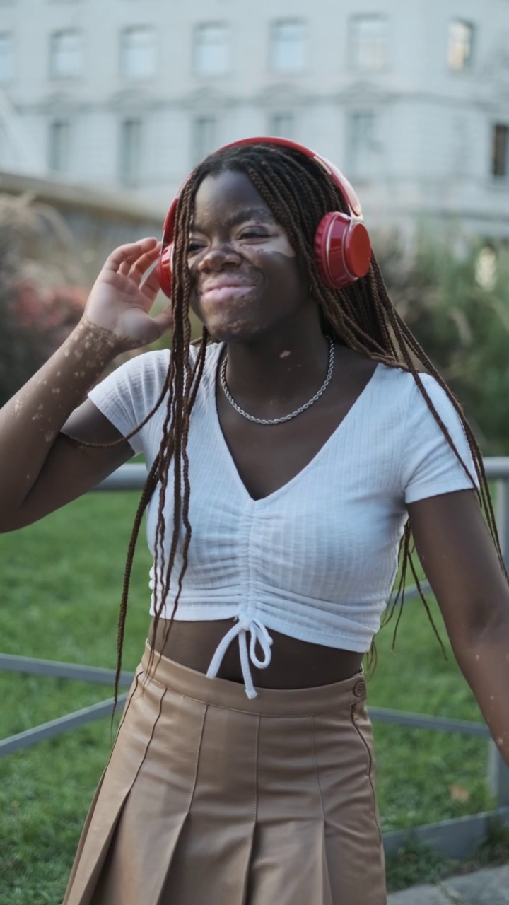 患白癜风的非裔美国妇女戴着耳机在街上听音乐，一边笑一边跳舞。视频下载