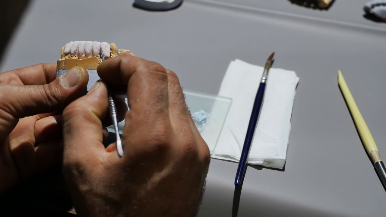 在牙科正畸车间的工作台上，一名牙科技术员的双手正在用锋利的手术刀制作可拆卸陶瓷假牙模型。义齿的生产和安装视频下载