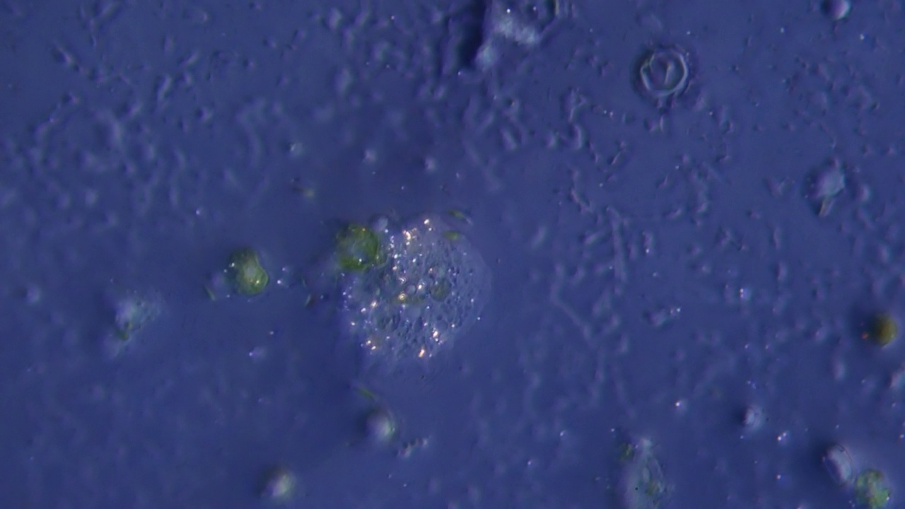 画面中央闪闪发光的变形虫，背景是深蓝色。微生物实验室。监测干旱非洲国家的饮用水质量视频下载
