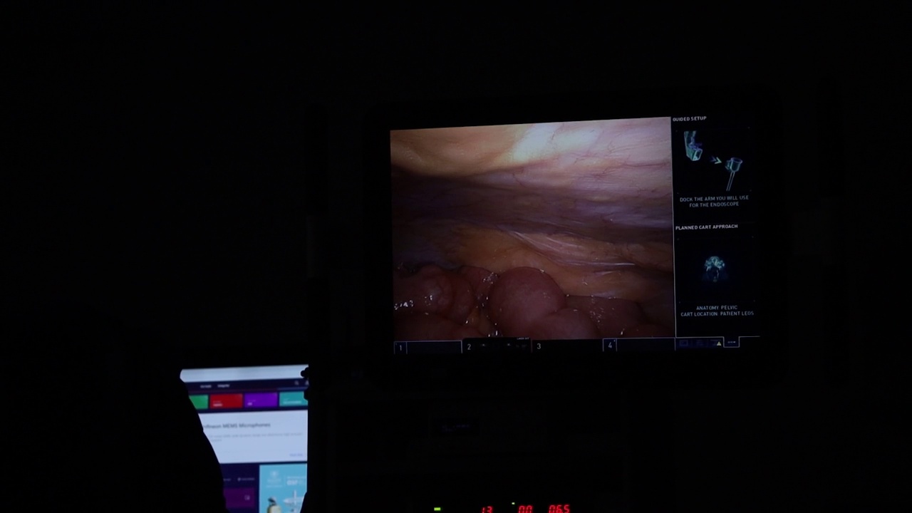 4K监视器反射的内镜病人在手术室库存视频。视频下载