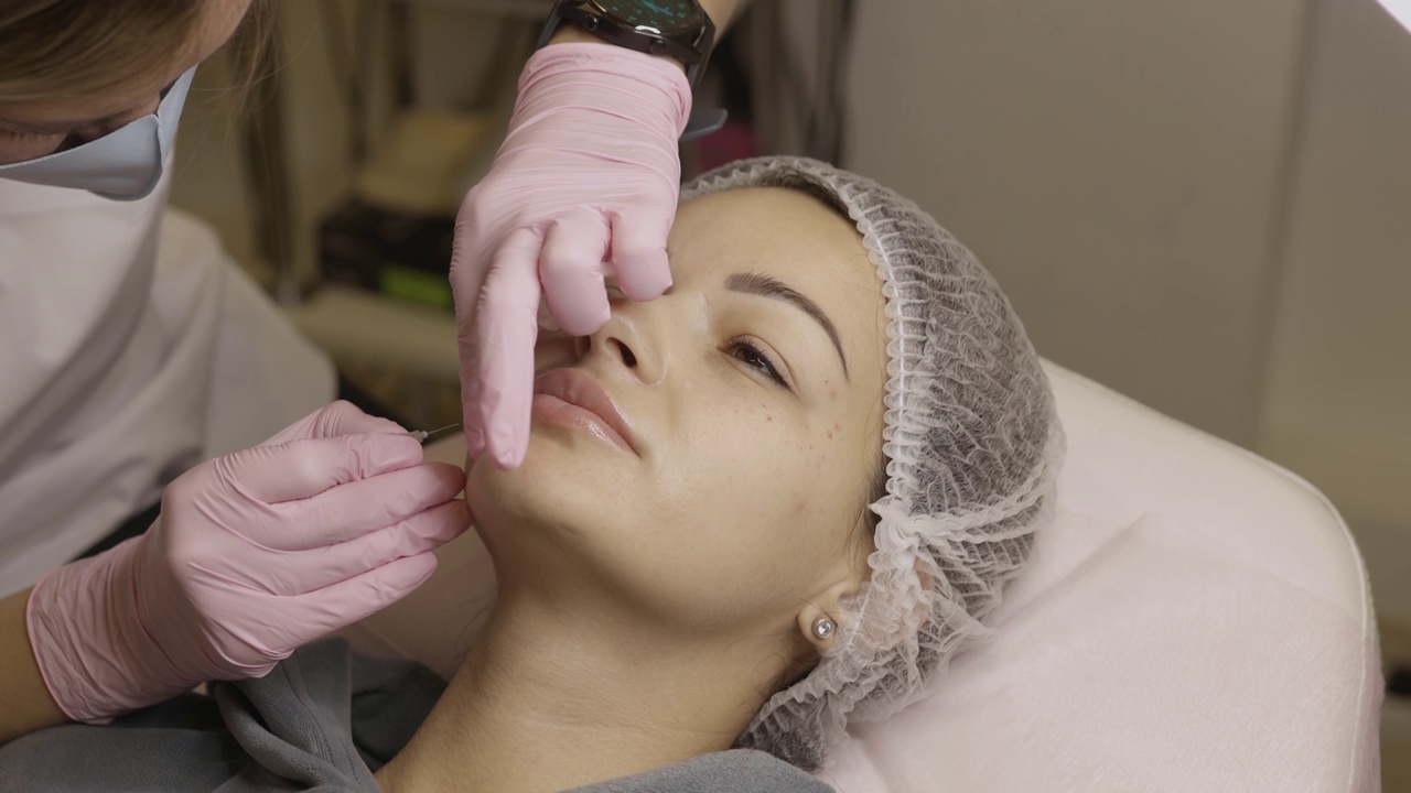 美丽的女人在美容诊所的程序。填充剂注射。医生戴着紫色手套在鼻唇襞注射。视频素材