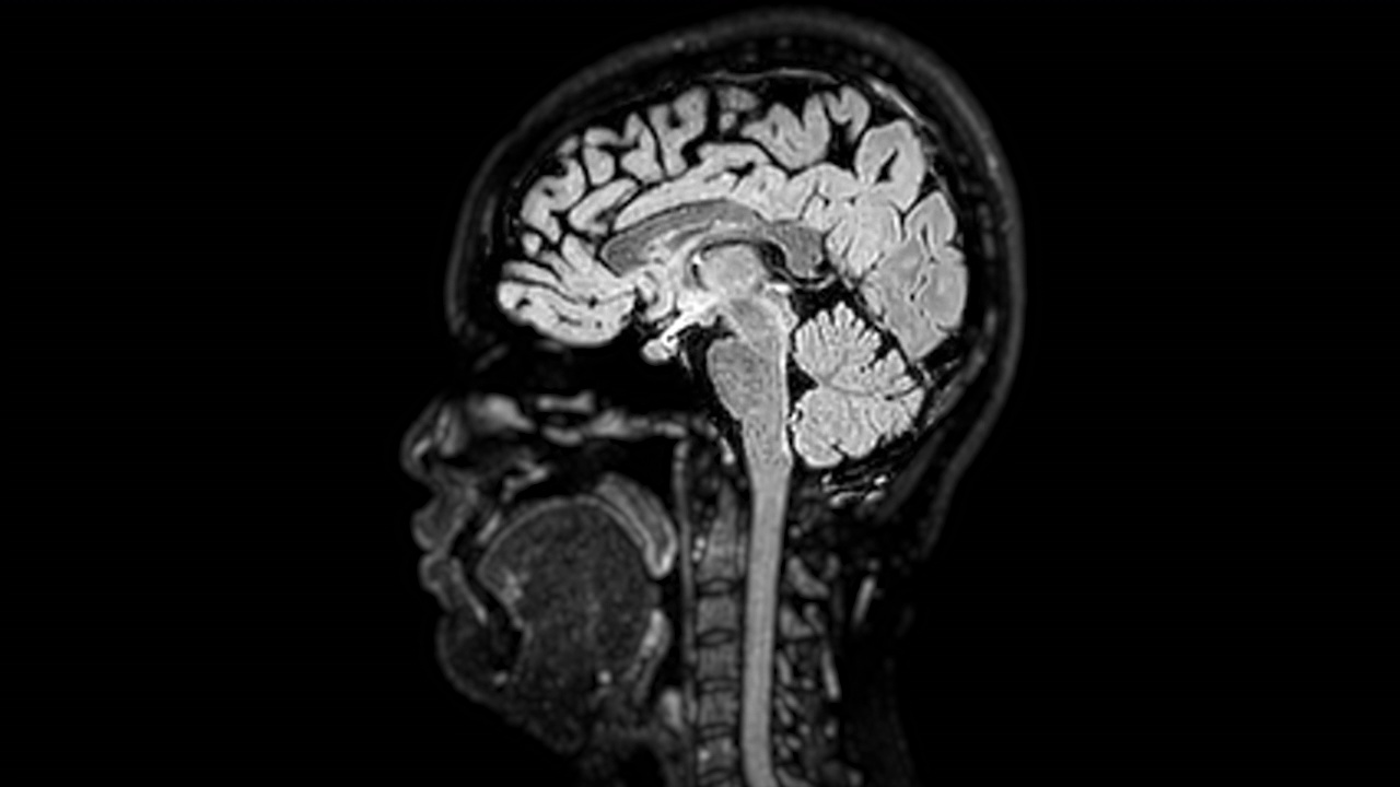 大脑MRI。视频下载