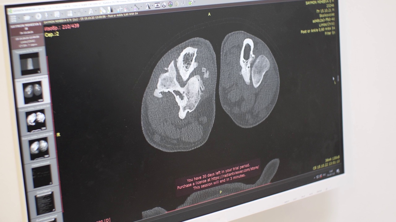 特写镜头。一位兽医在电脑显示器上检查宠物的核磁共振成像。医生正在寻找一种导致动物疼痛的核磁共振疾病。视频素材