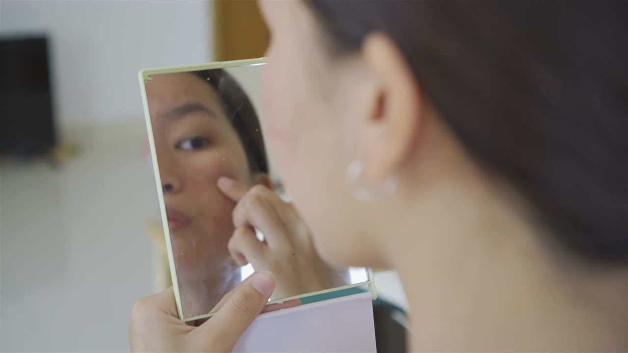 情绪不好的少女在镜子前看脸上出现痤疮和疤痕。视频下载