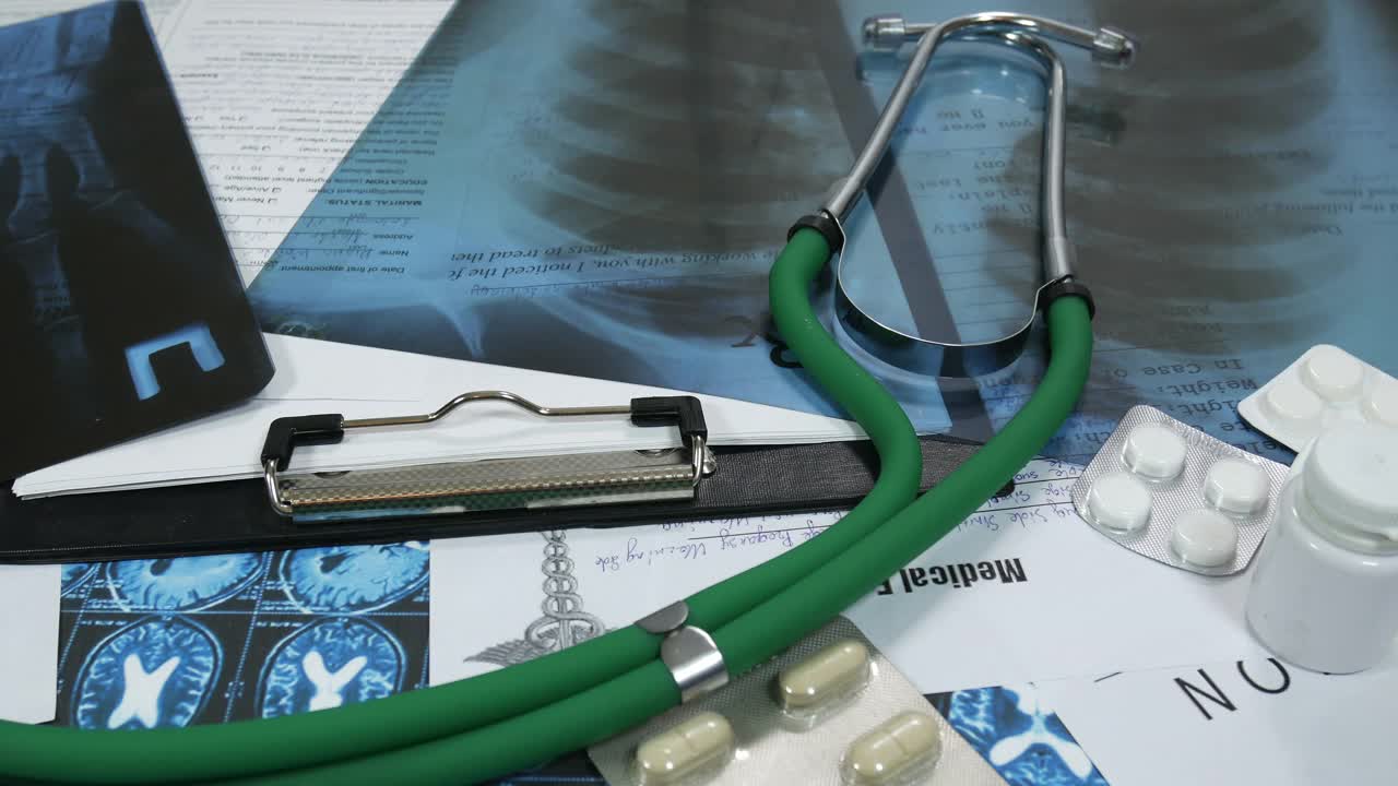 肺部的x光片和医生办公桌上的手视频下载