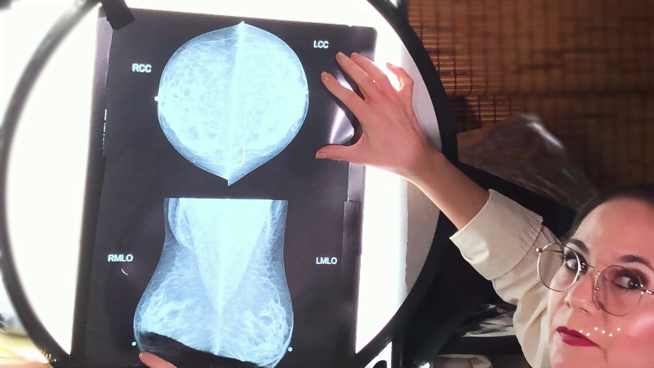 妇科医生分析x线乳房摄影照片，根据年龄诊断为囊性纤维化，锁定相机视频下载