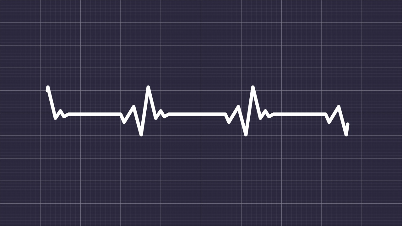 心跳脉搏率动画与网格背景。心率监测器的心电图哔哔声痕迹。脉搏痕迹。心律心电图或心电图。监测病人的健康状况。视频下载