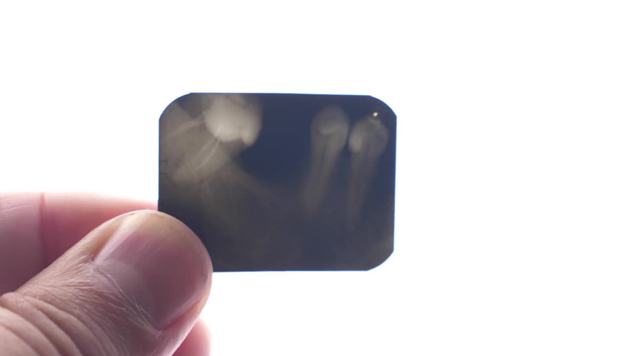 正在研究牙齿的x光图像。牙医。牙科治疗诊断。视频下载