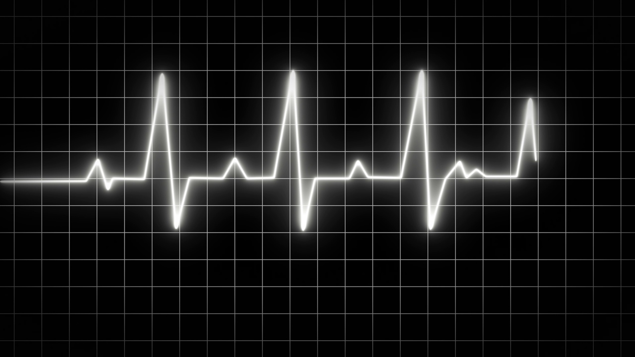 心电图心跳线，心电监护仪。心跳显示动画视频下载