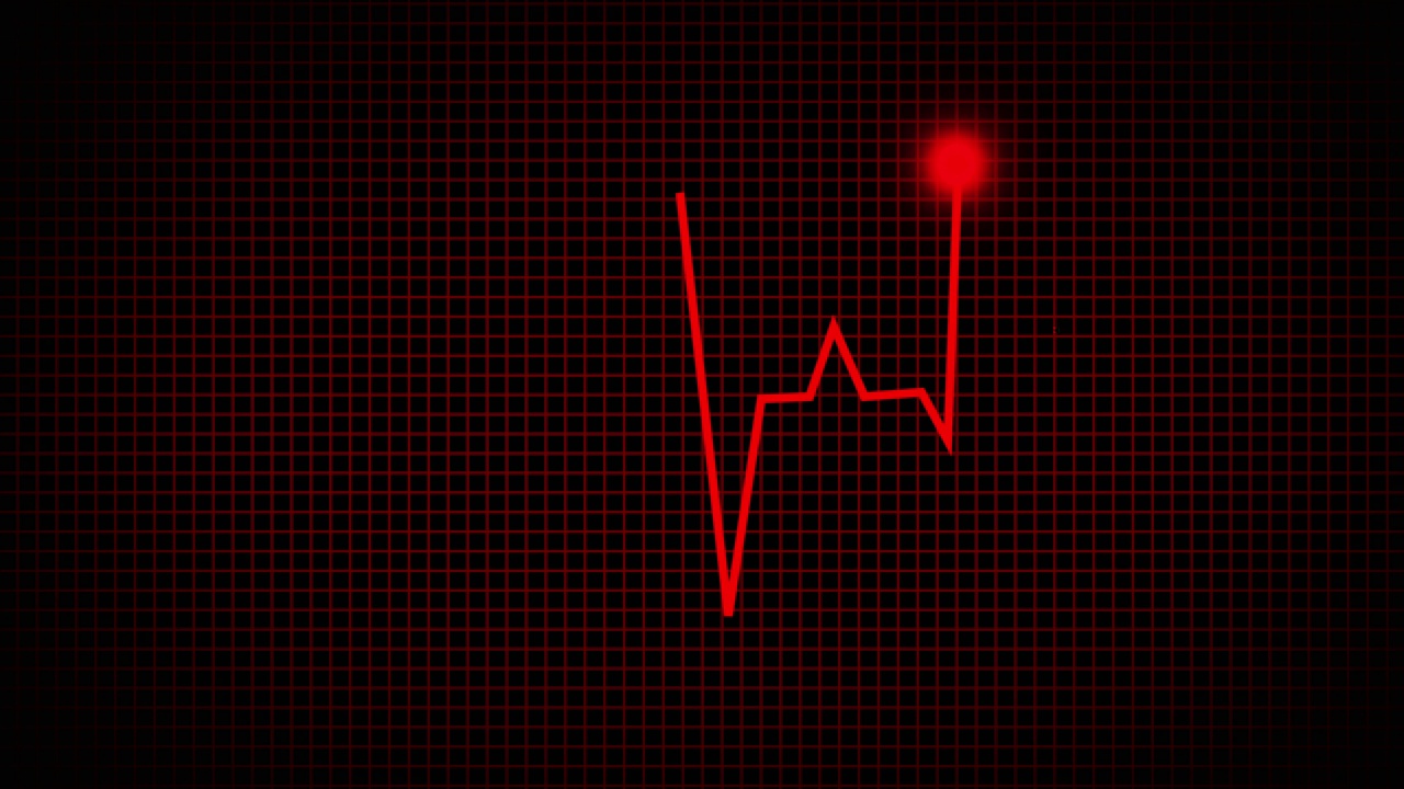心电监护仪和心跳线一个动画心跳显示。无限循环的4K。心电图和心电图的动画呈现。视频下载