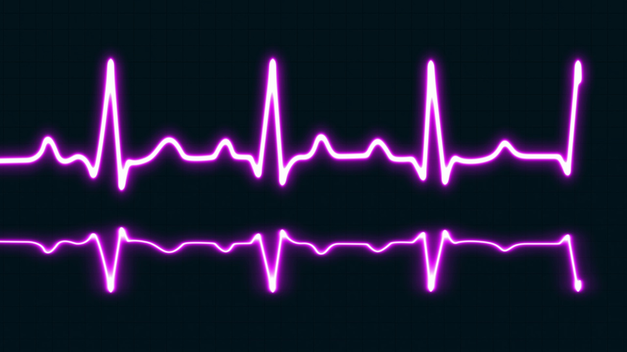 明亮的紫色霓虹心跳与爱的形状孤立的网格背景。医学概念和心电脉搏曲线图视频下载