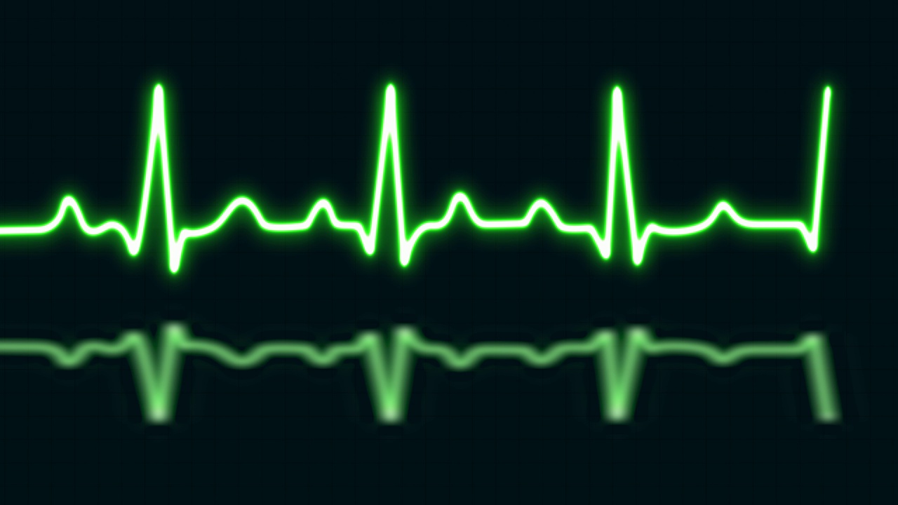 绿色霓虹心跳与爱的形状孤立在蓝色网格背景。医学概念和心电脉搏曲线图视频下载