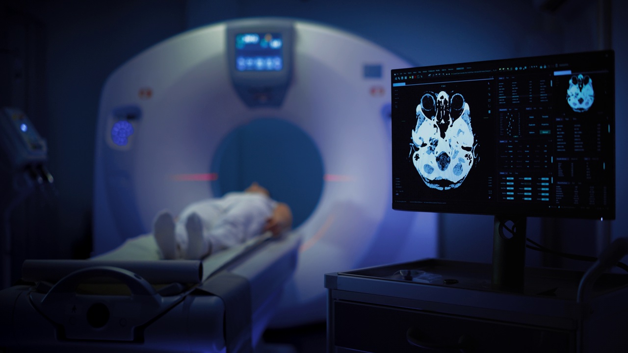 一个女性病人躺在CT或核磁共振扫描中，当机器扫描她的大脑时，床在机器内部移动。显示结果。医学实验室或医疗机构的录像视频下载