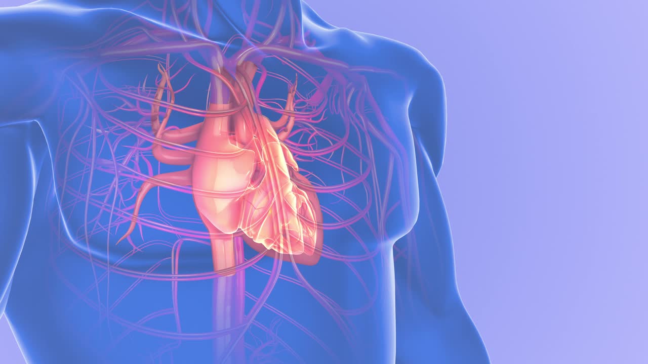 心脏动脉阻塞或动脉粥样硬化视频下载