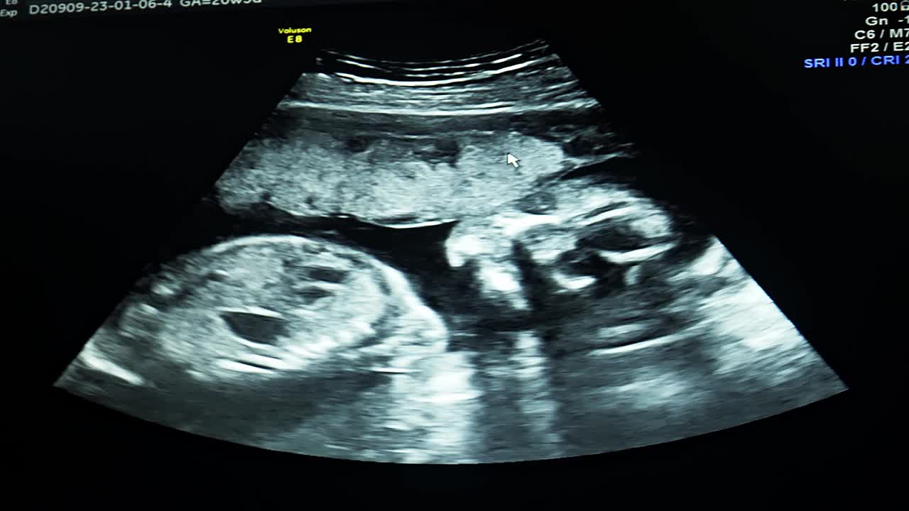 胎儿在子宫内的超声波特写视频素材