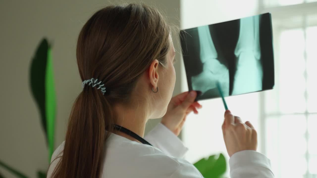 一位年轻的女医生手里拿着一张x光片，在白光的背景下仔细地检查着照片视频下载
