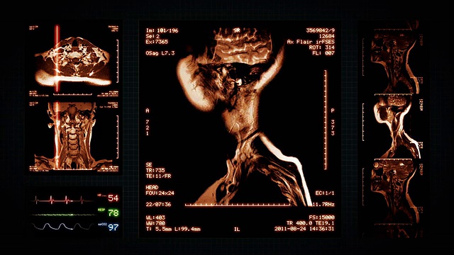 大脑，膝盖，颈部MRI扫描。琥珀。视频素材
