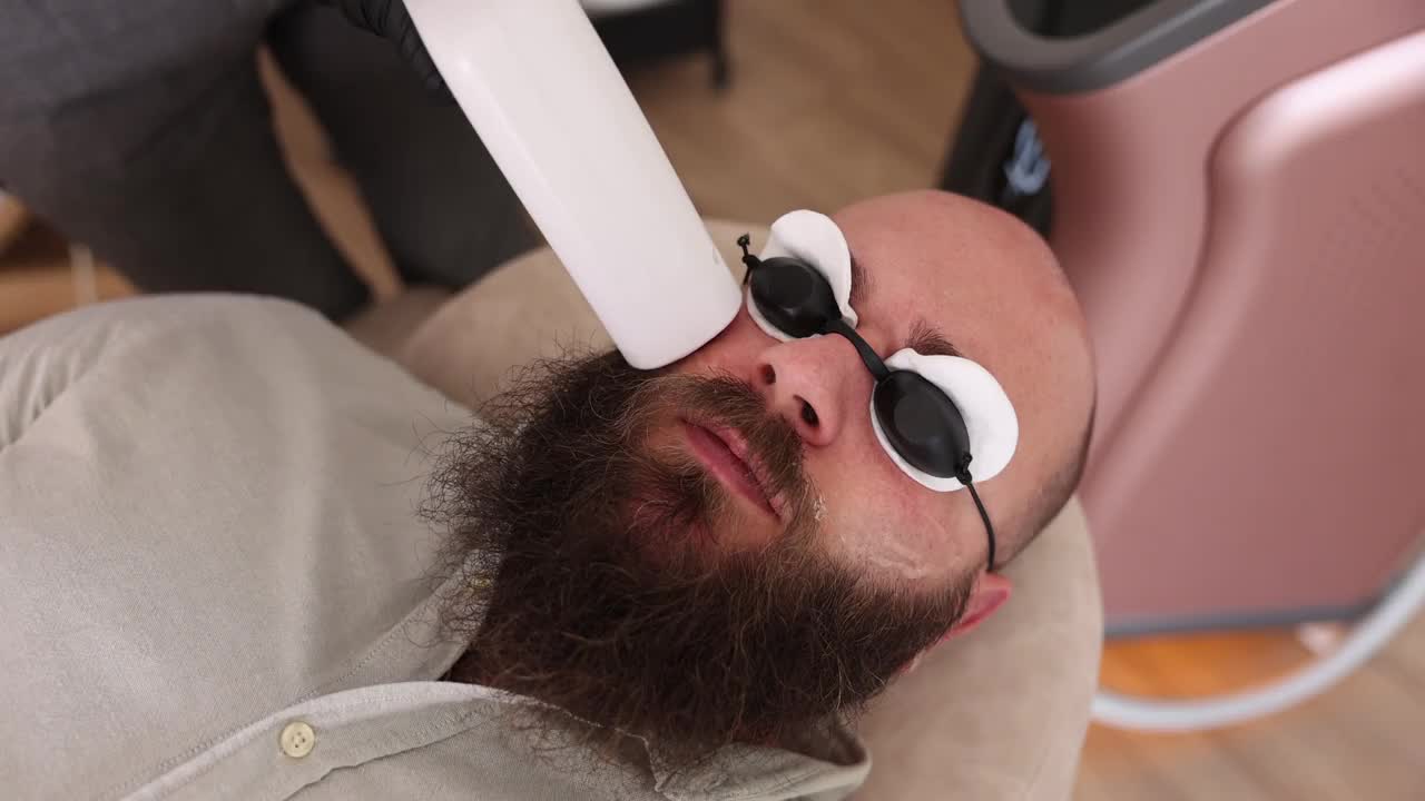 一名男子在美容院接受无痛激光去除面部毛发视频下载