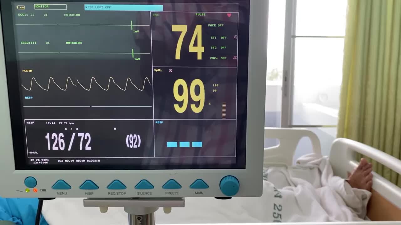 医院的病人心脏监护紧急心电图平板电缆视频下载