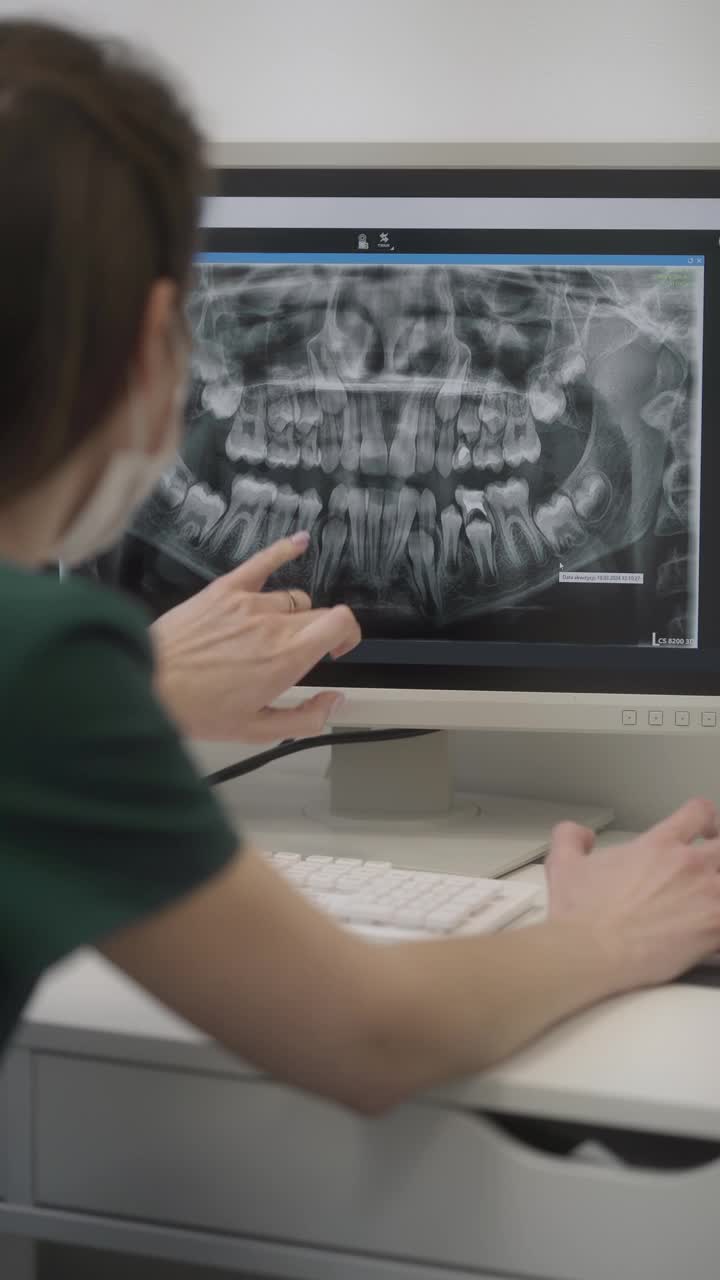 牙科老师用x光片给实习生看牙齿。医疗实践和教育视频下载