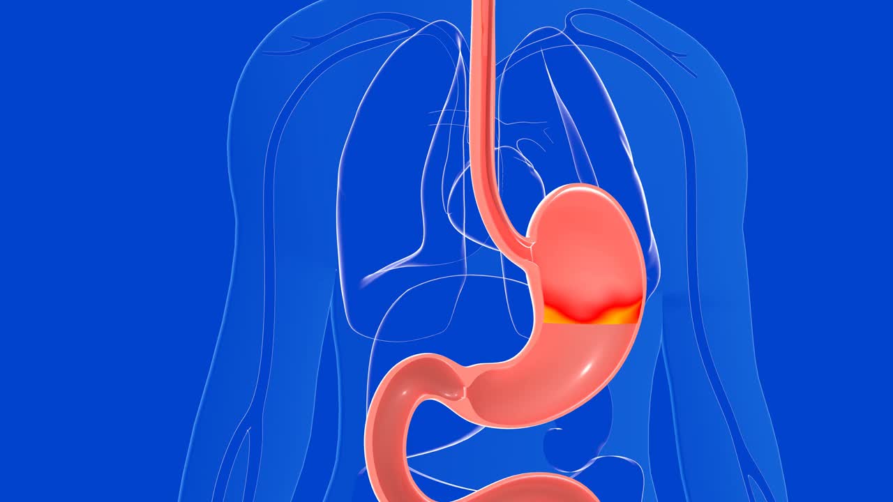 胃3D动画，治疗胃灼热和反流的药物。视频下载
