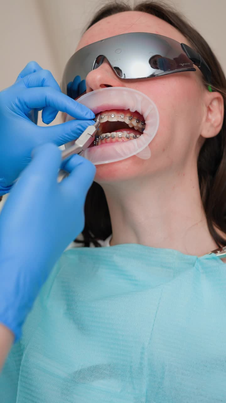 女牙医在光明牙科诊所为女病人戴牙套视频下载