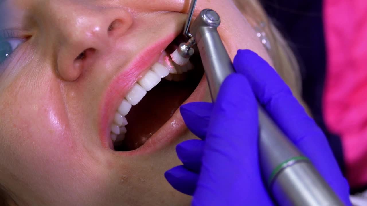牙医用机器给病人擦亮牙齿视频下载