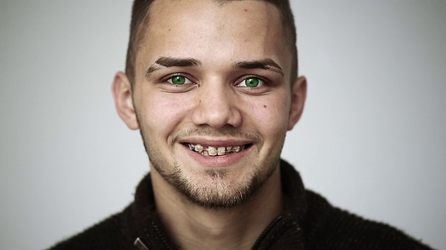 绿眼睛的男人微笑着，牙齿上还带着牙套视频下载