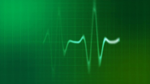 心电监护仪的心跳视频素材