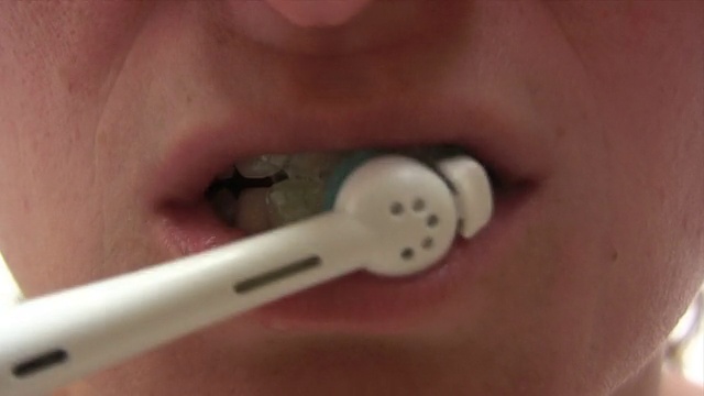 刷牙-延时视频素材