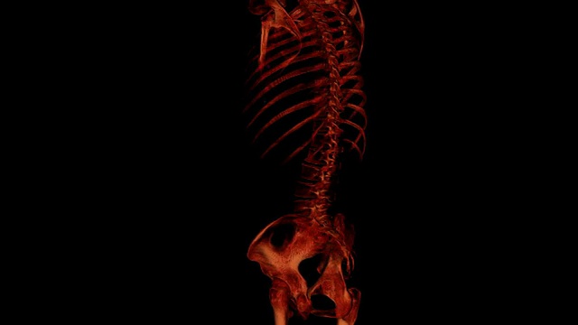 人体骨骼的CAT扫描视频下载