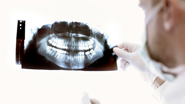 牙医在看牙齿x光。视频素材