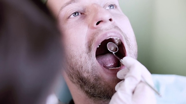 牙科检查。视频素材