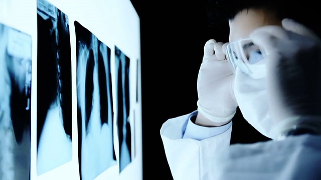 近距离看X射线扫描的年轻外科医生视频素材