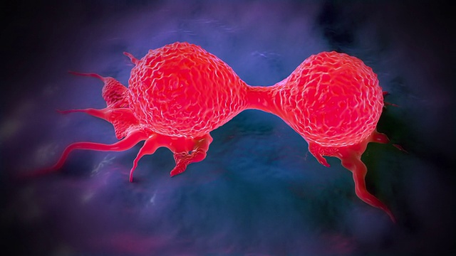 分裂的乳腺癌细胞。视频下载