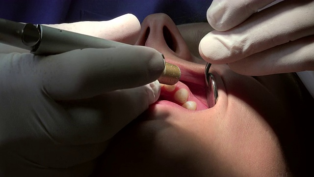 牙医练习表面麻醉视频下载