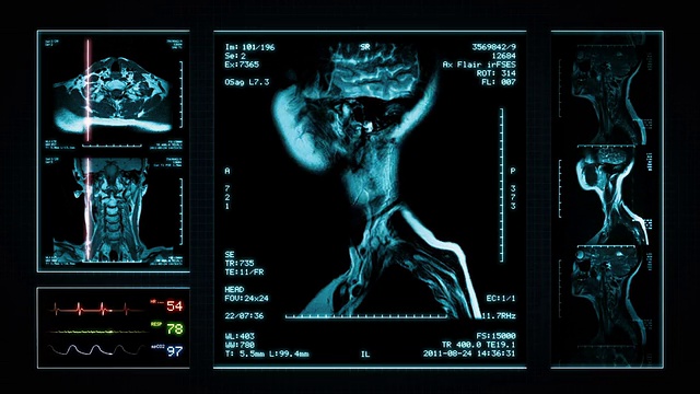 大脑，膝盖，颈部MRI扫描。蓝色的。视频素材