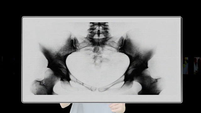 护士使用数字界面查看各种x光片视频下载