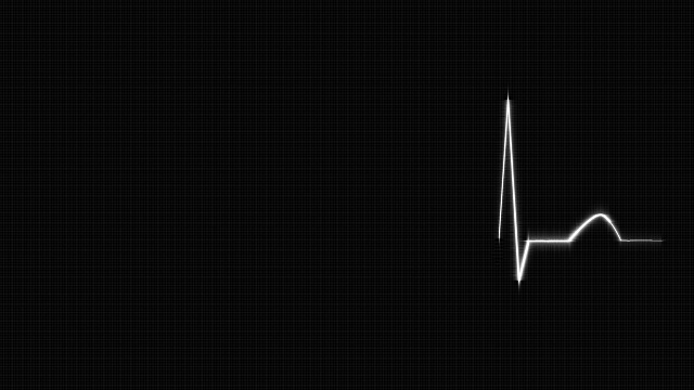 网格背景上的白色心跳心电图。视频下载